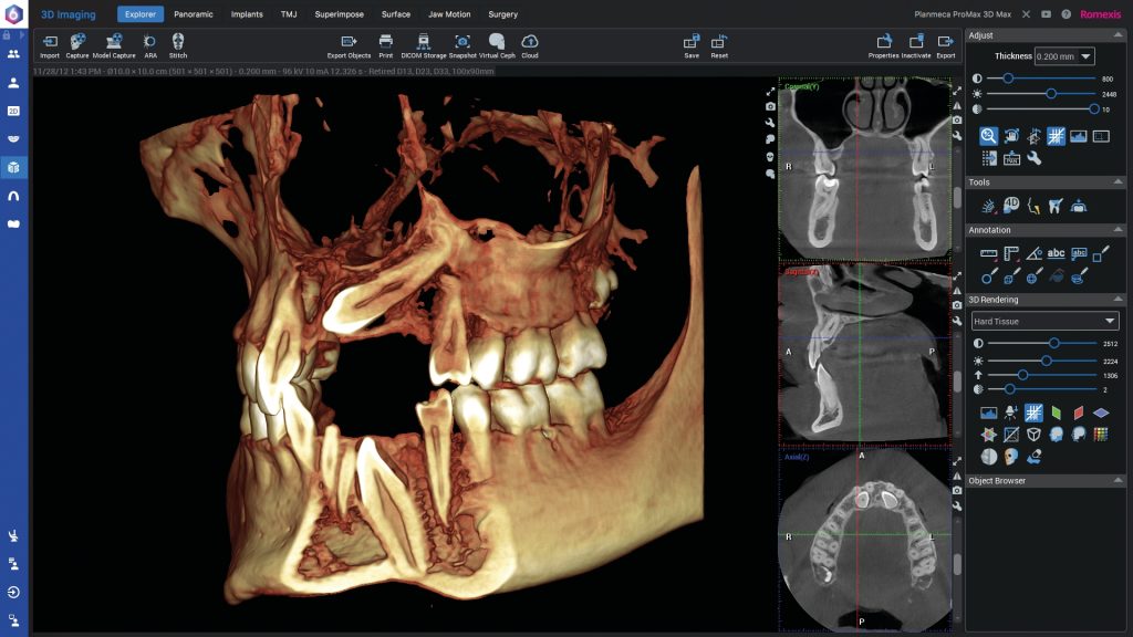 3D CBCT diagnostika