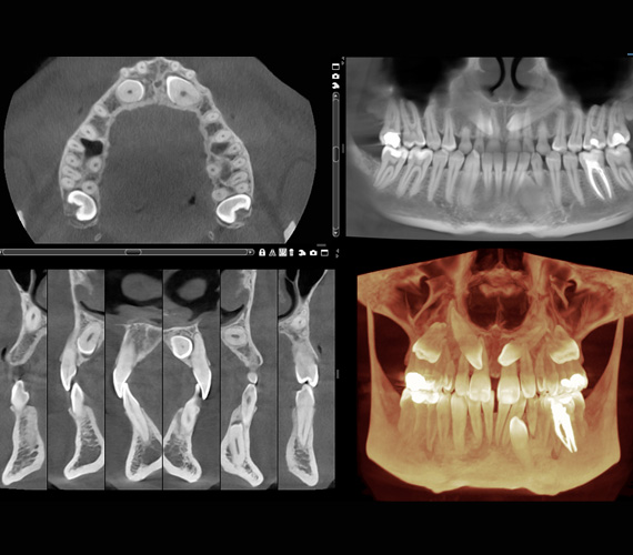 3D diagnostika