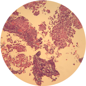 Lymph Node - Cell Block