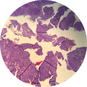 Parotid - Cell Block